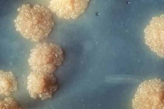Nuove molecole per combattere la tubercolosi multiresistente